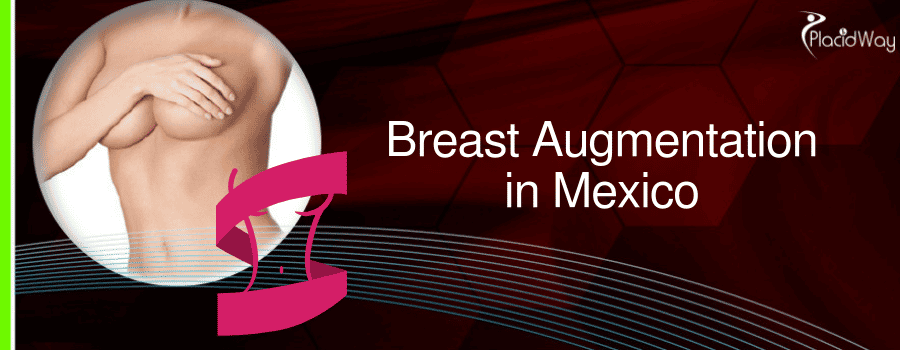 Breast Augmentation in Mexico